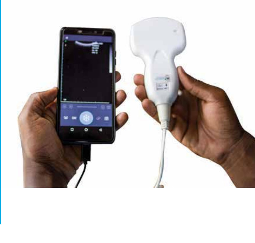 M-Scan Device with Mobile